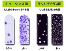 まずは唾液検査から始めましょう