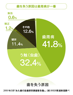 歯周病は虫歯よりも歯を失う確率が高い病気です